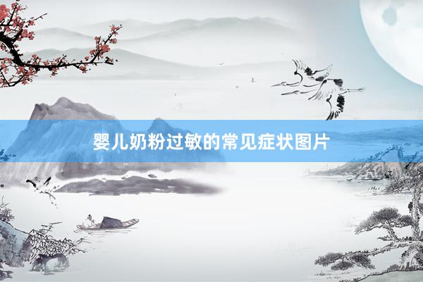 婴儿奶粉过敏的常见症状图片